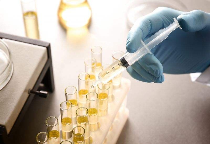 尿檢能檢測(cè)出來(lái)什么問題？