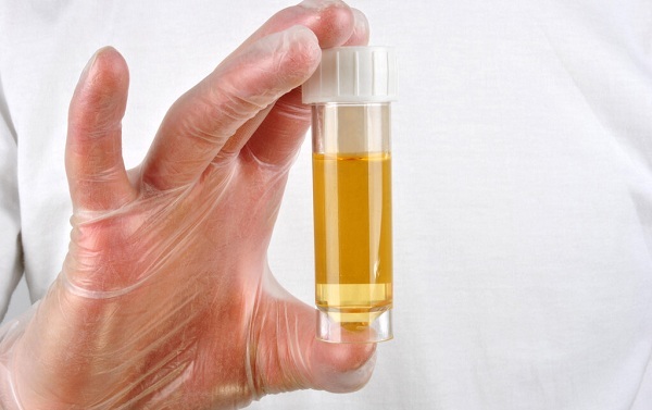 尿檢能檢測(cè)出來(lái)什么問題？