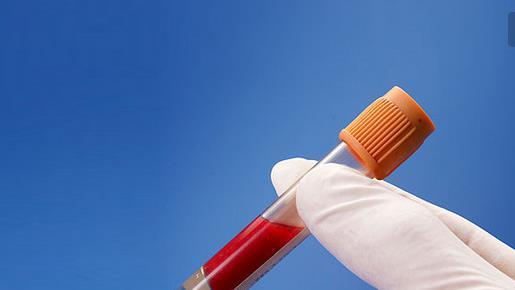 健康體檢一般檢查哪些項目？